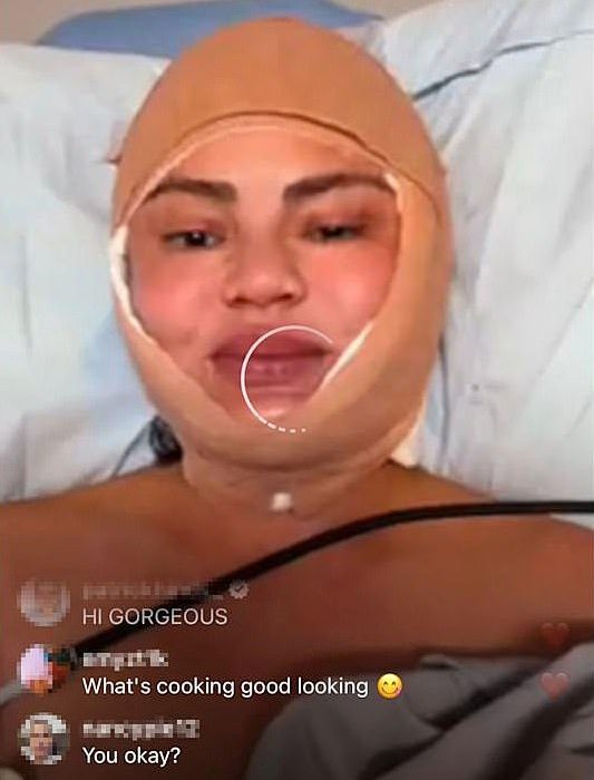 39 -Year -old Chrissy Teigen