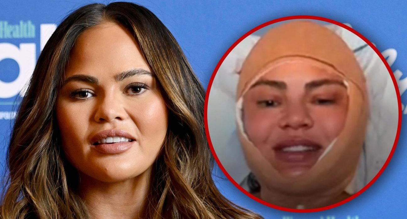 A relação do Instagram de Chrissy Teigen revelará a cirurgia facial